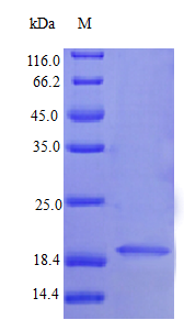 Human IFNA1 protein (Active)