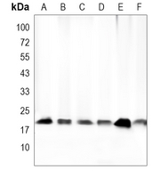 CG alpha Rabbit Polyclonal Antibody