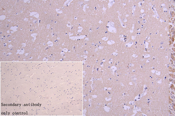 NQO2 Antibody