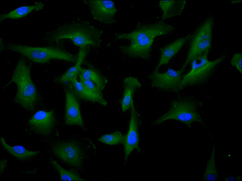 NQO2 Antibody