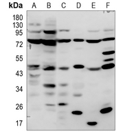 OST48 Rabbit Polyclonal Antibody
