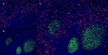 CD163 Mouse Monoclonal Antibody (EDHu-1)