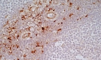 CD163 Mouse Monoclonal Antibody (EDHu-1)