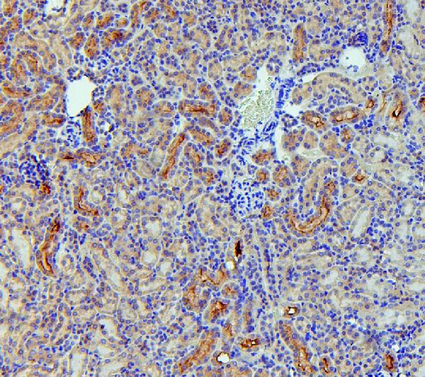 SGLT2/SLC5A2 Antibody