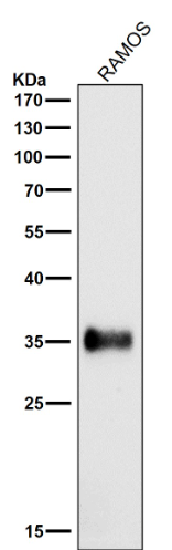 HLA-DRA/Hla Dr/DRA Rabbit Monoclonal Antibody