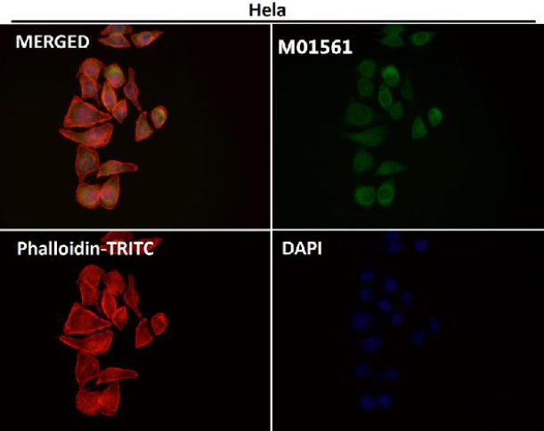 Integrin alpha V ITGAV Rabbit Monoclonal Antibody