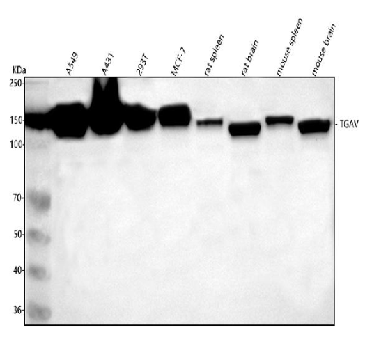 Integrin alpha V ITGAV Rabbit Monoclonal Antibody