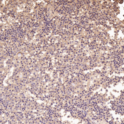 Integrin alpha V ITGAV Rabbit Monoclonal Antibody