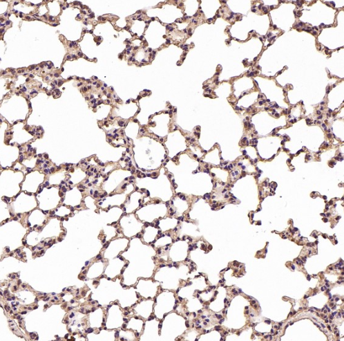 Integrin alpha V ITGAV Rabbit Monoclonal Antibody