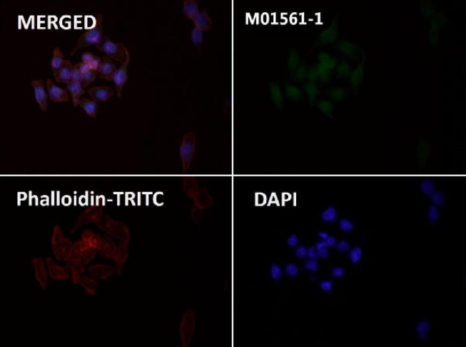 Integrin alpha V ITGAV Rabbit Monoclonal Antibody