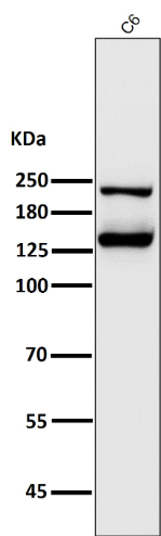 Integrin alpha V ITGAV Rabbit Monoclonal Antibody