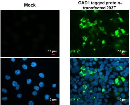 GAD67 antibody