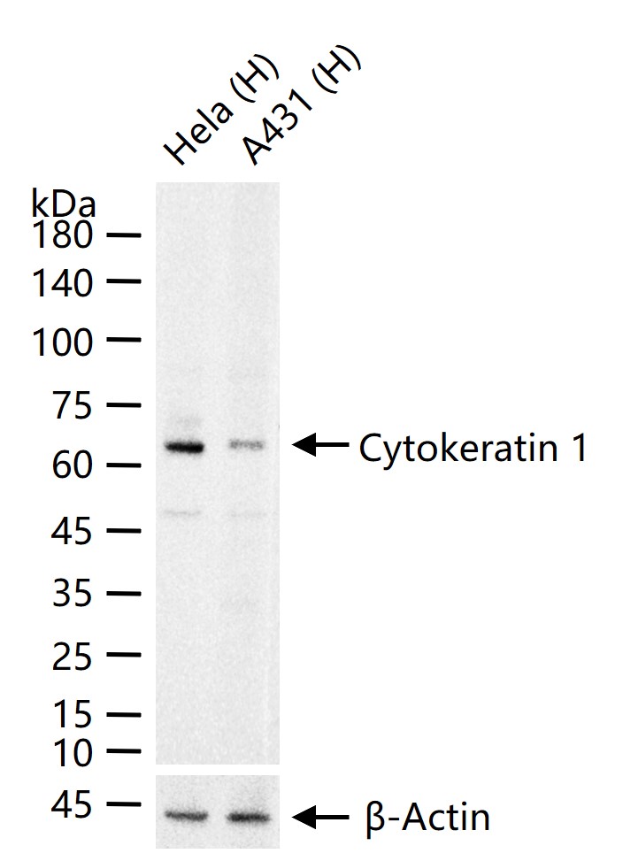 Cytokeratin 1 Recombinant Rabbit Monoclonal Antibody
