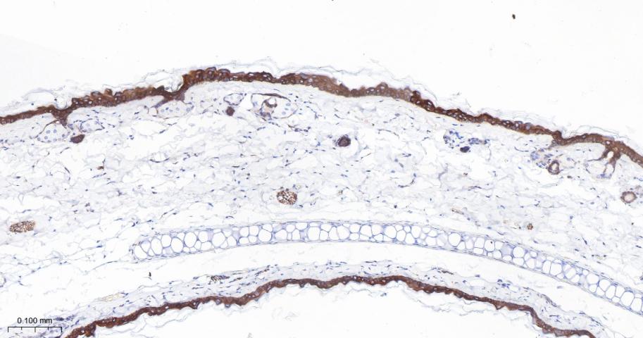 Cytokeratin 1 Recombinant Rabbit Monoclonal Antibody