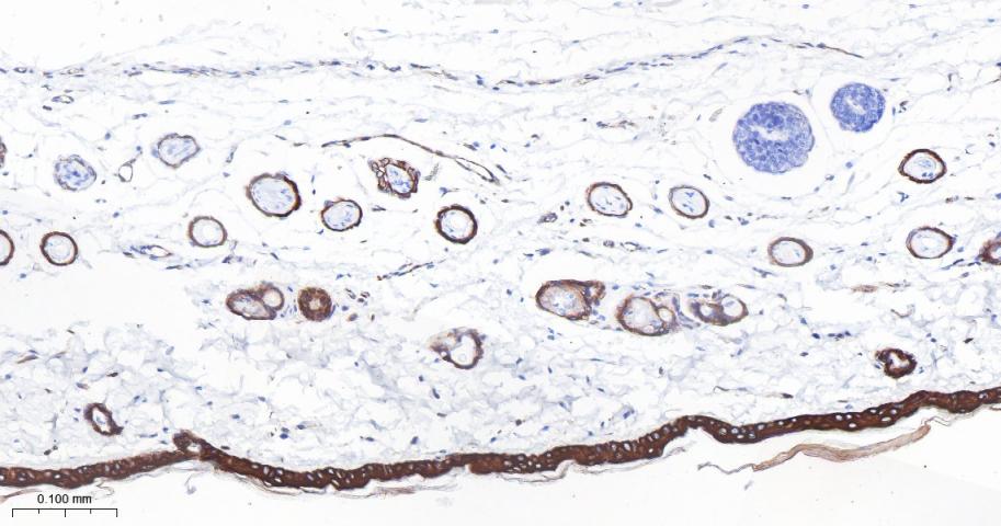 Cytokeratin 1 Recombinant Rabbit Monoclonal Antibody