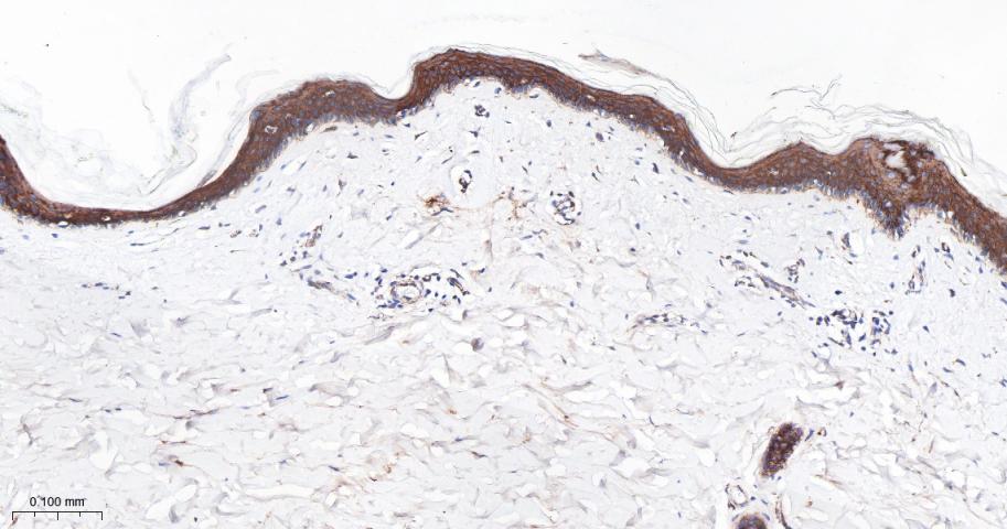 Cytokeratin 1 Recombinant Rabbit Monoclonal Antibody