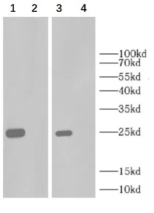 Human TNFalpha ELISA Kit