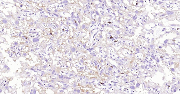 CD163 Recombinant Rabbit Monoclonal Antibody