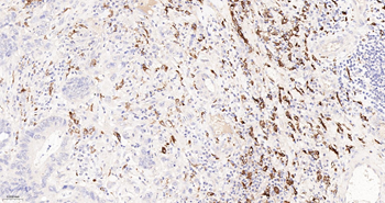 CD163 Recombinant Rabbit Monoclonal Antibody