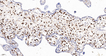 CD163 Recombinant Rabbit Monoclonal Antibody