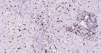 CD163 Recombinant Rabbit Monoclonal Antibody