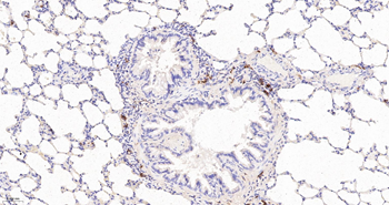 CD163 Recombinant Rabbit Monoclonal Antibody