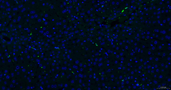 CD163 Recombinant Rabbit Monoclonal Antibody