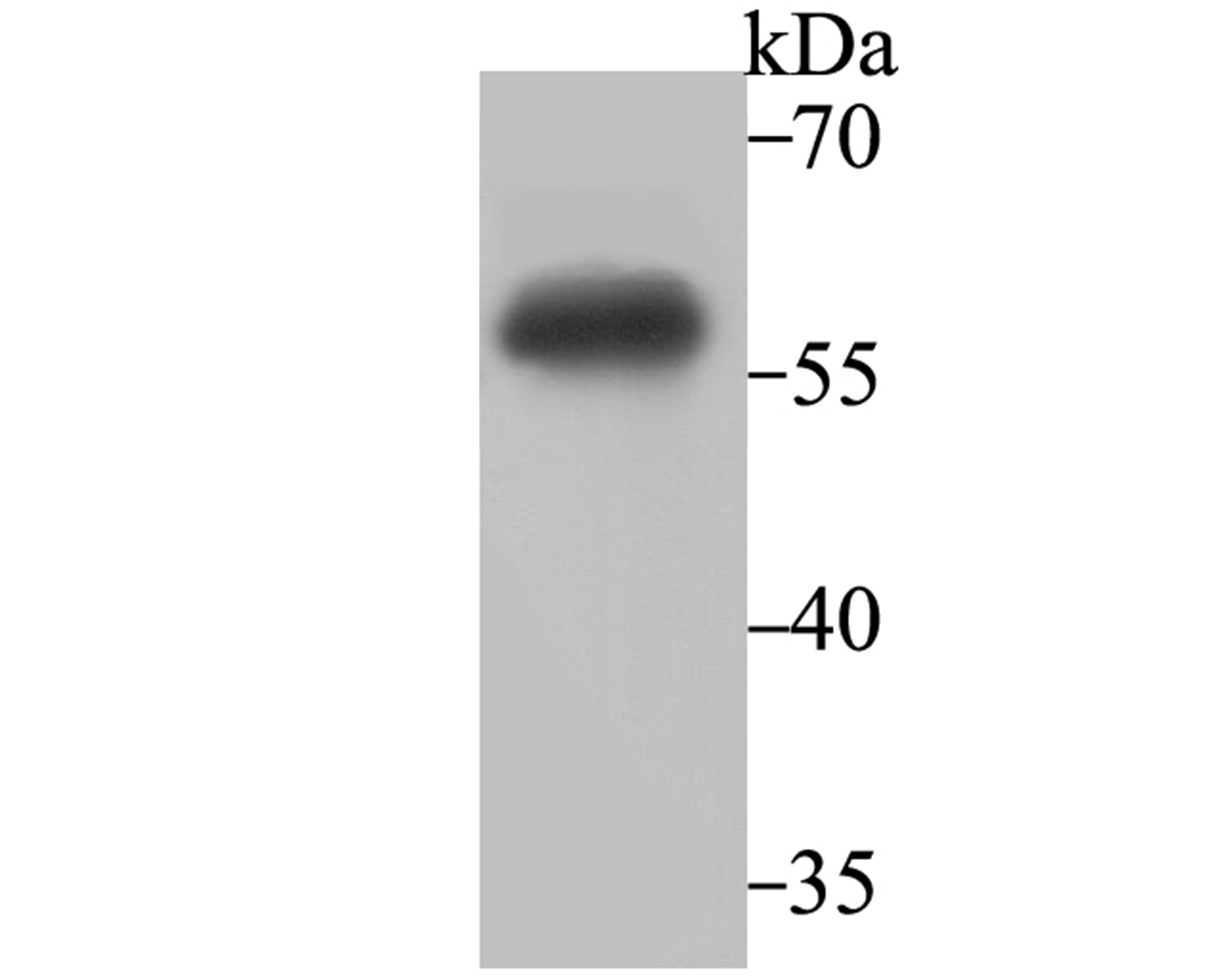 IMPDH2 Antibody