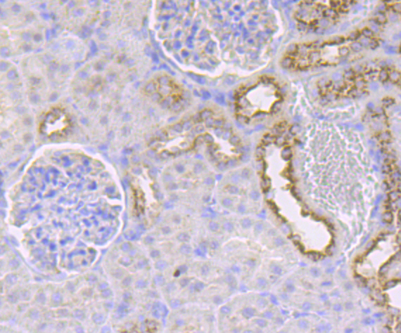IMPDH2 Antibody
