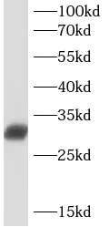 HLA DMA Rabbit Polyclonal Antibody