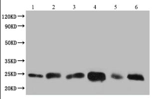 Cell Supernatant Exosome Isolation Kit