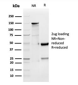 GDF9 Antibody