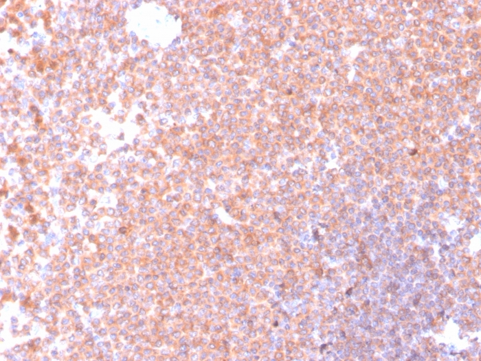 RETN Antibody