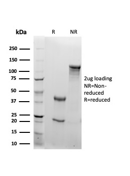 RBP4 Antibody