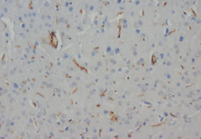 NEFH Mouse Monoclonal Antibody