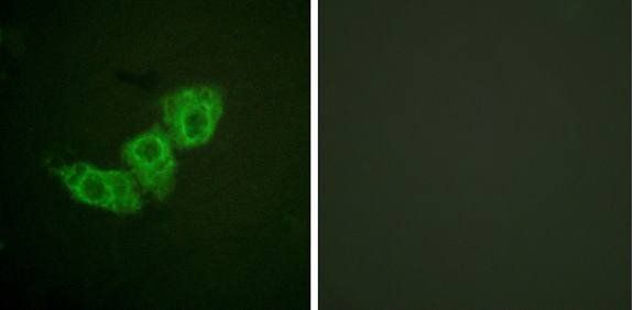 EGFR (Phospho-Thr678) Antibody