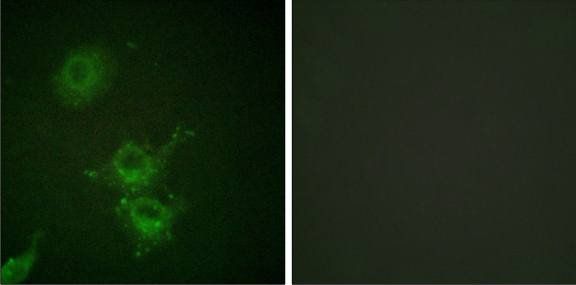 EGFR (Phospho-Thr693) Antibody