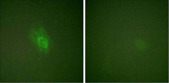 IκB-β (Phospho-Ser23) Antibody