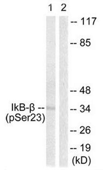 IκB-β (Phospho-Ser23) Antibody