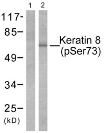 Keratin 8 (Phospho-Ser74) Antibody