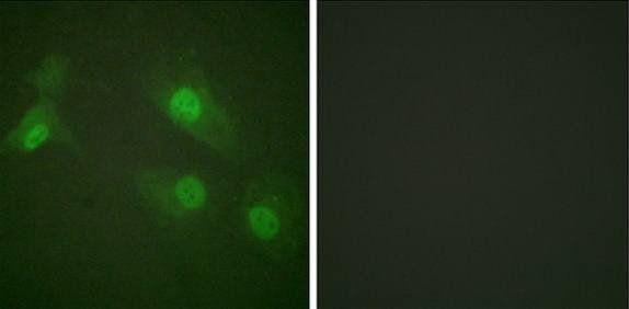 NF-κB p105/p50 (Phospho-Ser927) Antibody