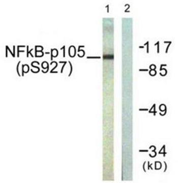 NF-κB p105/p50 (Phospho-Ser927) Antibody