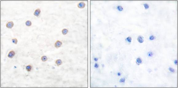 Tyrosine Hydroxylase (Phospho-Ser40) Antibody
