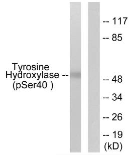 Tyrosine Hydroxylase (Phospho-Ser40) Antibody