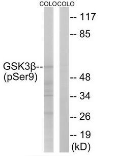 GSK3β (Phospho-Ser9) Antibody