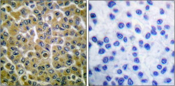 PLCG2 (Phospho-Tyr753) Antibody