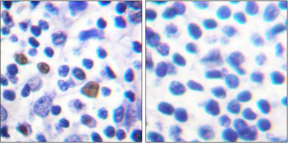 NF-κB p65 (Phospho-Ser529) Antibody