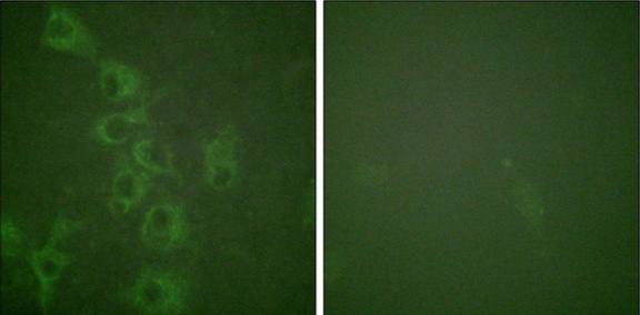 Histamine H1 Receptor (Phospho-Ser398) Antibody