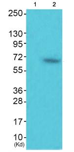 TAK1 (Phospho-Thr184) Antibody