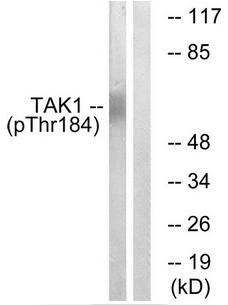 TAK1 (Phospho-Thr184) Antibody